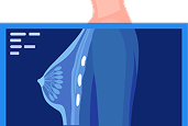 Breast Cancer Treatment in Hyderabad