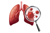 Lung Cancer Treatment in Hyderabad